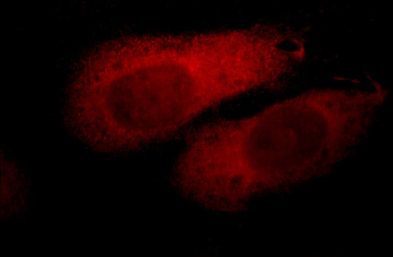 Immunofluorescent analysis of HepG2 cells, using PHLPP antibody Catalog No:113825 at 1:50 dilution and Rhodamine-labeled goat anti-rabbit IgG (red).