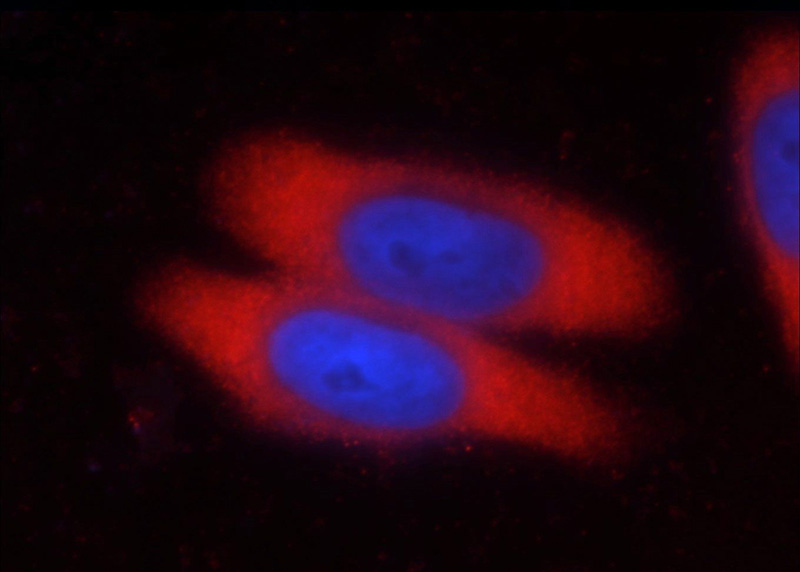 Immunofluorescent analysis of HeLa cells using Catalog No:107217(FKBP52 Antibody) at dilution of 1:25 and Rhodamine-Goat anti-Mouse IgG