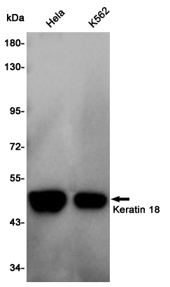 Western blot detection of Keratin 18 in Hela,K562 cell lysates using Keratin 18 Rabbit pAb(1:1000 diluted).Predicted band size:48KDa.Observed band size:48KDa.