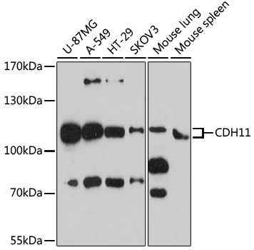 Western blot - CDH11 Polyclonal Antibody 