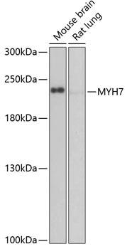 Western blot - MYH7 Polyclonal Antibody 