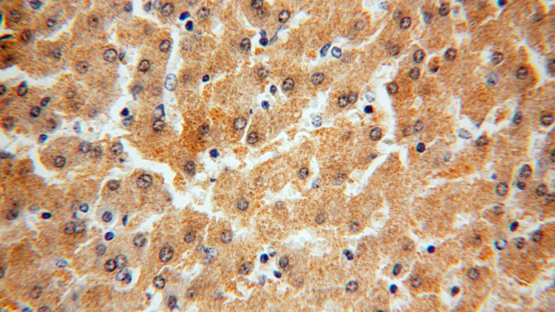 Immunohistochemical of paraffin-embedded human liver using Catalog No:115073(SDSL antibody) at dilution of 1:100 (under 40x lens)