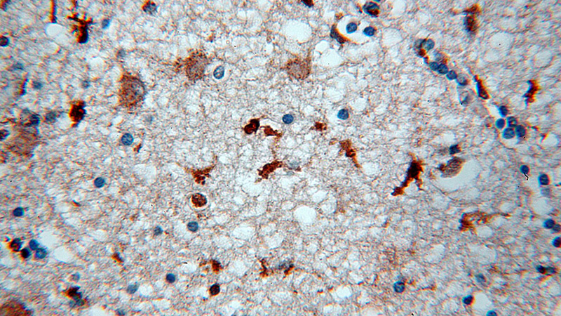 Immunohistochemical of paraffin-embedded human brain using Catalog No:112431(MAPK11 antibody) at dilution of 1:50 (under 40x lens)