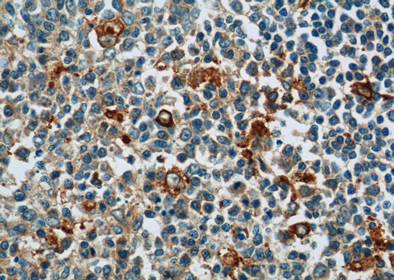 Immunohistochemistry of paraffin-embedded human tonsillitis tissue slide using Catalog No:110902(GCET2 Antibody) at dilution of 1:50 (under 40x lens)