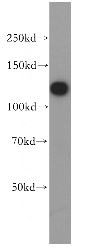 HEK-293 cells were subjected to SDS PAGE followed by western blot with Catalog No:111513(HNRNPU antibody) at dilution of 1:500