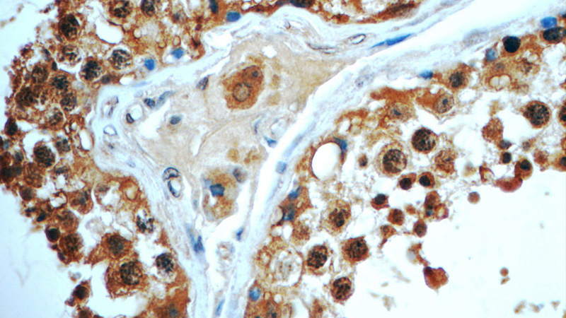 Immunohistochemistry of paraffin-embedded human testis tissue slide using Catalog No:111579(HYDIN Antibody) at dilution of 1:50 (under 40x lens)