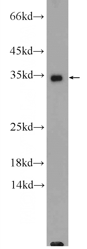 PC-13 cells were subjected to SDS PAGE followed by western blot with Catalog No:110820(GADD45A Antibody) at dilution of 1:600