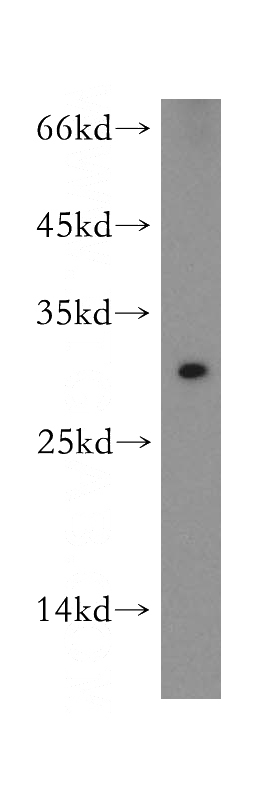 K-562 cells were subjected to SDS PAGE followed by western blot with Catalog No:115489(SocS3 antibody) at dilution of 1:500