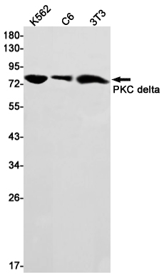 Western blot detection of PKC delta in K562,C6,3T3 cell lysates using PKC delta Rabbit mAb(1:1000 diluted).Predicted band size:78kDa.Observed band size:78kDa.