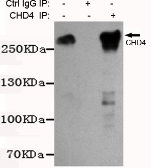 Immunoprecipitation analysis of K562 cell lysates using CHD4 mouse mAb.