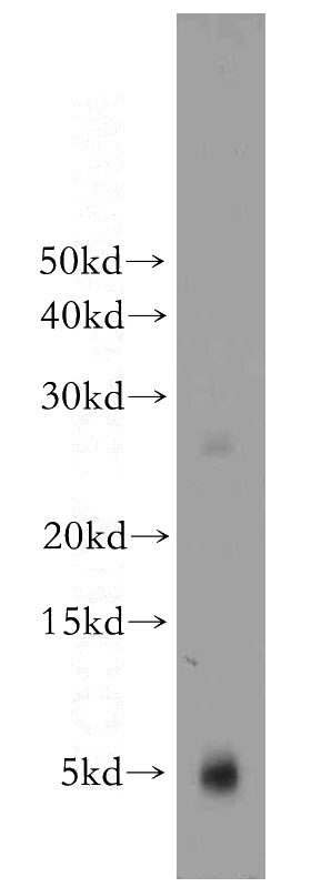 mouse heart tissue were subjected to SDS PAGE followed by western blot with Catalog No:113855(PKIG antibody) at dilution of 1:200