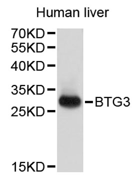 Western blot - BTG3 Polyclonal Antibody 