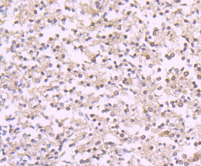 Fig1: Immunohistochemical analysis of paraffin-embedded human liver tissue using anti-Reelin antibody. Counter stained with hematoxylin.