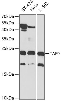 Western blot - TAF9 Polyclonal Antibody 