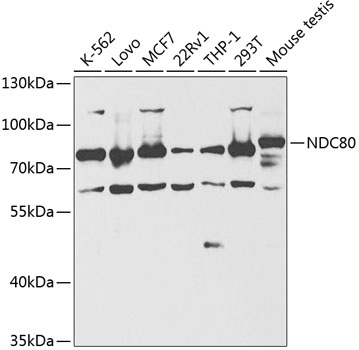 Western blot - NDC80 Polyclonal Antibody 