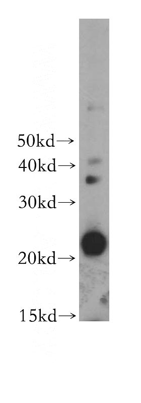 RAW264.7 cells were subjected to SDS PAGE followed by western blot with Catalog No:111095(CSF2 antibody) at dilution of 1:400