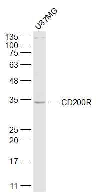 Fig5: Sample:; U87MG(Human) Cell Lysate at 30 ug; Primary: Anti-CD200R at 1/1000 dilution; Secondary: IRDye800CW Goat Anti-Rabbit IgG at 1/20000 dilution; Predicted band size: 34 kD; Observed band size: 34 kD
