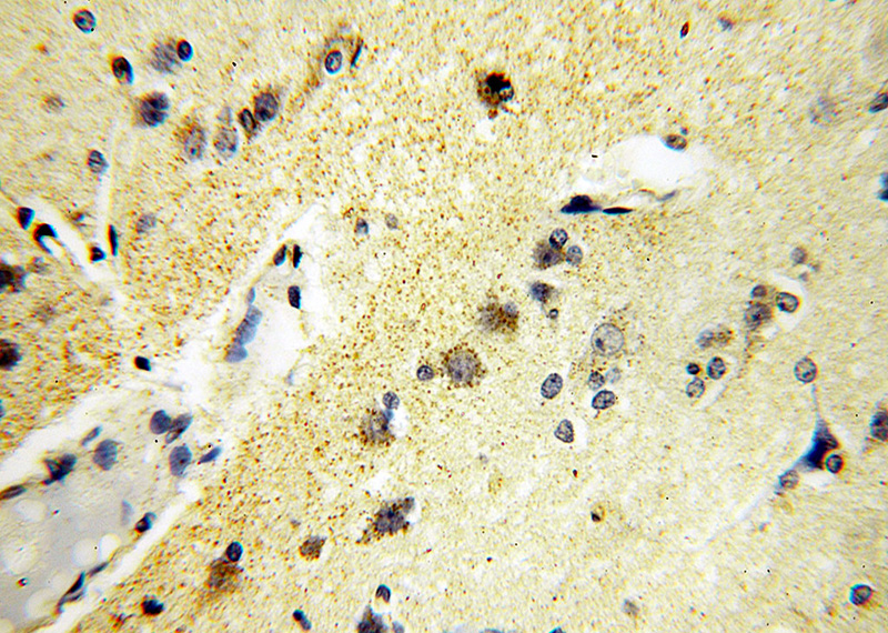 Immunohistochemical of paraffin-embedded human brain using Catalog No:112610(MICAL2 antibody) at dilution of 1:100 (under 40x lens)