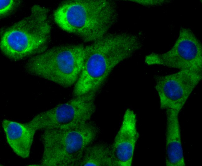 Fig3: ICC staining CD137 (green) in A549 cells. The nuclear counter stain is DAPI (blue). Cells were fixed in paraformaldehyde, permeabilised with 0.25% Triton X100/PBS.
