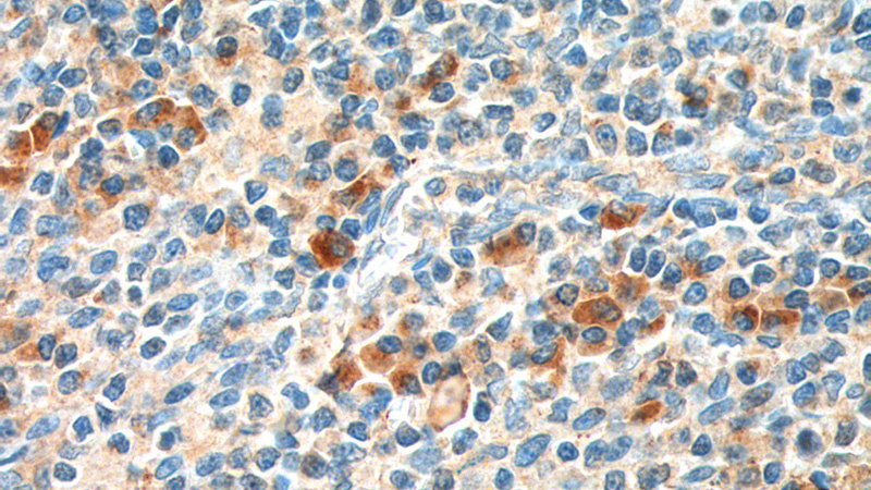 Immunohistochemistry of paraffin-embedded human tonsillitis tissue slide using Catalog No:111708(HTR1A Antibody) at dilution of 1:200 (under 40x lens). heat mediated antigen retrieved with Tris-EDTA buffer(pH9).