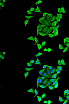Immunofluorescence - KCNN3 Polyclonal Antibody 