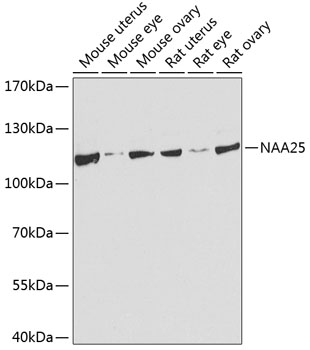 Western blot - NAA25 Polyclonal Antibody 