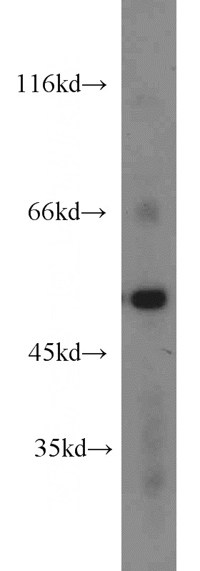 mouse lung tissue were subjected to SDS PAGE followed by western blot with Catalog No:110130(dynactin-2 antibody) at dilution of 1:500