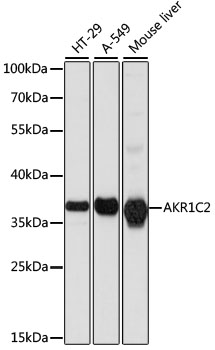 Western blot - AKR1C2 Polyclonal Antibody 