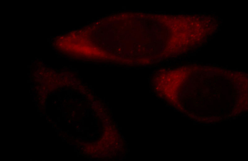 Immunofluorescent analysis of MCF-7 cells, using EIF3M antibody Catalog No: at 1:25 dilution and Rhodamine-labeled goat anti-mouse IgG (red).