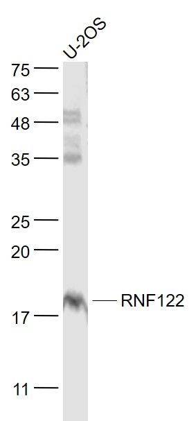Fig1: Sample:; U-2OS(Human) Cell Lysate at 30 ug; Primary: Anti- RNF122 at 1/1000 dilution; Secondary: IRDye800CW Goat Anti-Rabbit IgG at 1/20000 dilution; Predicted band size: 17 kD; Observed band size: 18 kD
