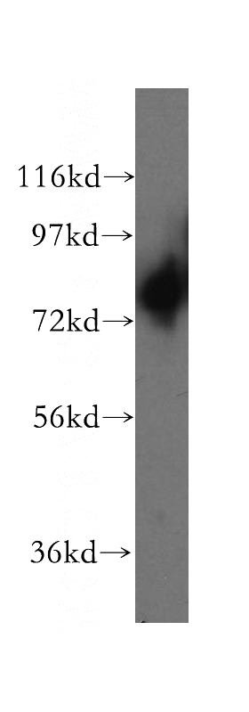 mouse testis tissue were subjected to SDS PAGE followed by western blot with Catalog No:109830(DDX4,VASA antibody) at dilution of 1:200