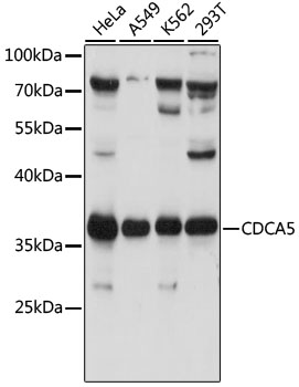Western blot - CDCA5 Polyclonal Antibody 