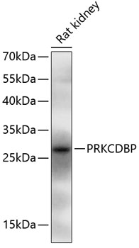 Western blot - PRKCDBP Polyclonal Antibody 