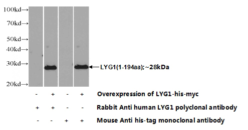 Transfected HEK-293 cells were subjected to SDS PAGE followed by western blot with Catalog No:112406(LYG1 Antibody) at dilution of 1:700