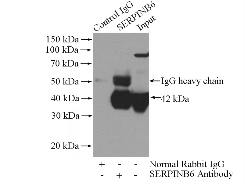 IP Result of anti-SERPINB6 (IP:Catalog No:115204, 4ug; Detection:Catalog No:115204 1:500) with human placenta tissue lysate 1520ug.