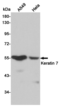 Western blot detection of Keratin 7 in A549 and Hela cell lysates using Keratin 7 mouse mAb (1:500 diluted).Predicted band size:51KDa.Observed band size:51KDa.
