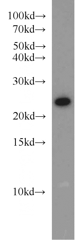 HeLa cells were subjected to SDS PAGE followed by western blot with Catalog No:114460(RAB8A antibody) at dilution of 1:1000