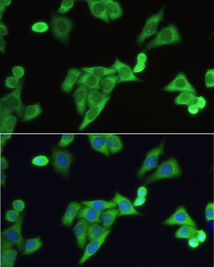 Immunofluorescence - SLC2A9 Polyclonal Antibody 