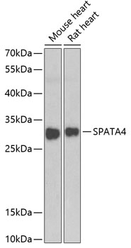 Western blot - SPATA4 Polyclonal Antibody 