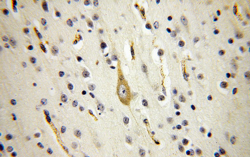 Immunohistochemical of paraffin-embedded human brain using Catalog No:115659(SQRDL antibody) at dilution of 1:100 (under 40x lens)