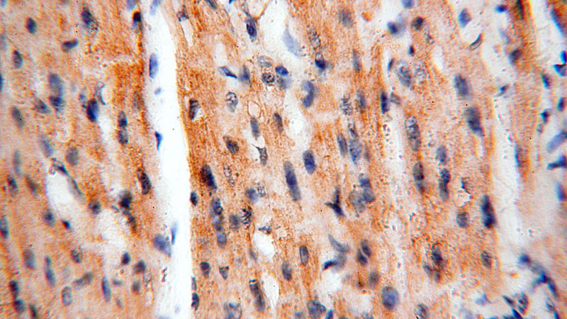 Immunohistochemical of paraffin-embedded human heart using Catalog No:112580(MECR antibody) at dilution of 1:100 (under 40x lens)