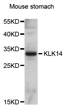 Western blot - KLK14 Polyclonal Antibody 