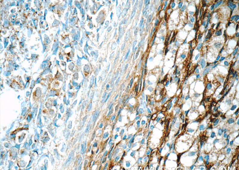 Immunohistochemistry of paraffin-embedded human ovary tissue slide using Catalog No:111544(HSD17B11 Antibody) at dilution of 1:50 (under 40x lens)