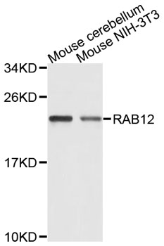 Western blot - RAB12 Polyclonal Antibody 