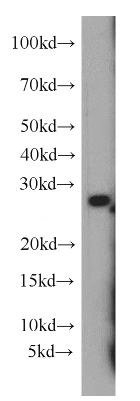 Raji cells were subjected to SDS PAGE followed by western blot with Catalog No:111423(HLA-DQA2 antibody) at dilution of 1:300