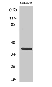 Fig1:; Western Blot analysis of various cells using KKIALRE Polyclonal Antibody diluted at 1: 500