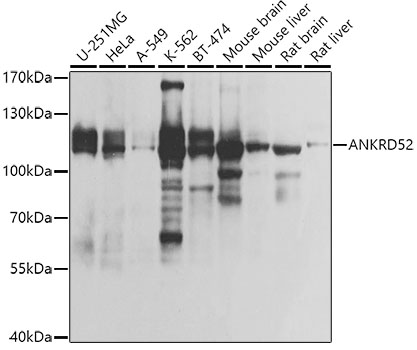 Western blot - ANKRD52 Polyclonal Antibody 