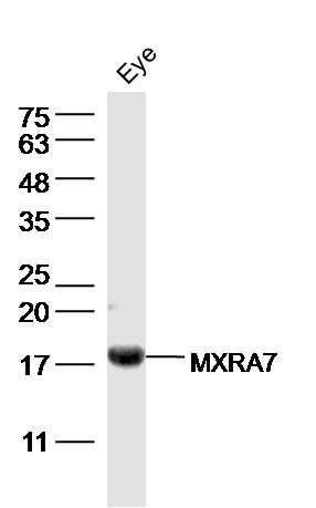 Fig1: Sample: Eye (Mouse) Lysate at 40 ug; Primary: Anti-MXRA7 at 1/300 dilution; Secondary: IRDye800CW Goat Anti-Rabbit IgG at 1/20000 dilution; Predicted band size: 21 kD; Observed band size: 18 kD