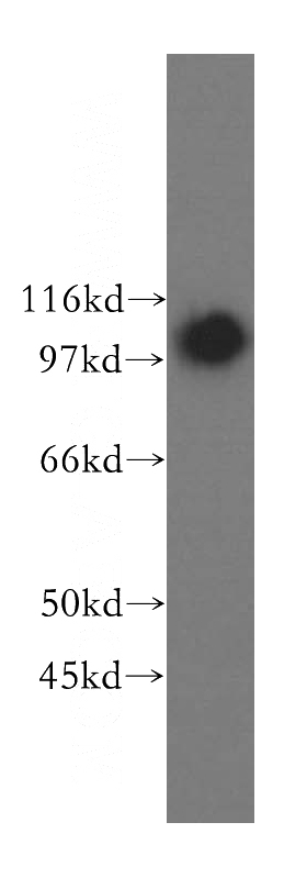 human adrenal gland tissue were subjected to SDS PAGE followed by western blot with Catalog No:113260(NNT antibody) at dilution of 1:300