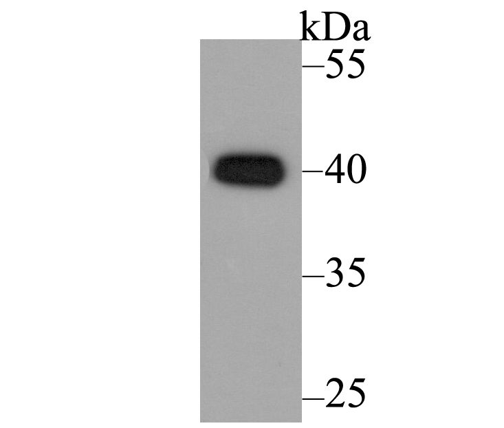 Fig1: Western blot analysis of CACNG5 on LOVO cell lysate using anti-CACNG5 antibody at 1/200 dilution.